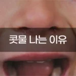 콧물이 나는 이유, 알고 보면 우리 몸의 똑똑한 방어 시스템