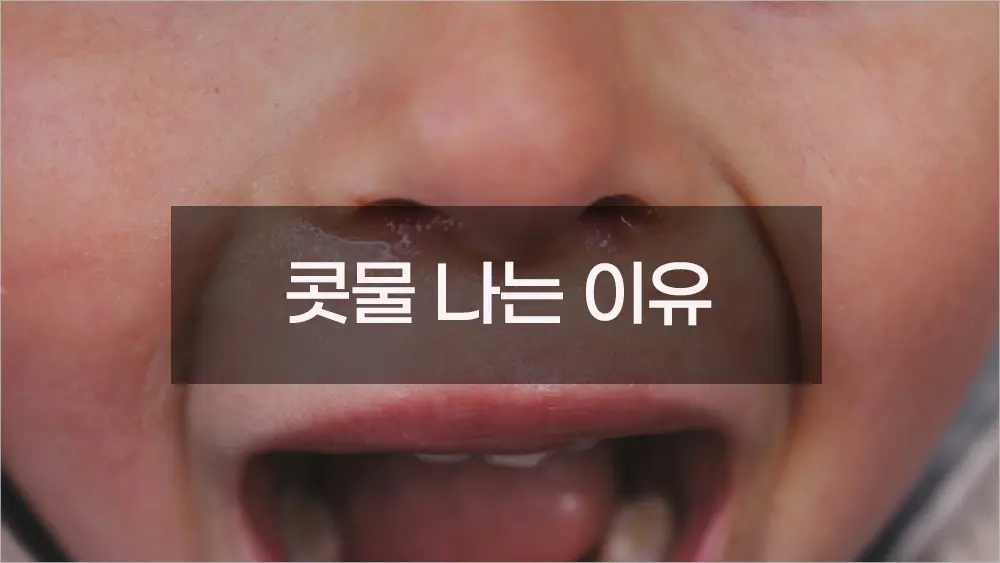콧물이 나는 이유, 알고 보면 우리 몸의 똑똑한 방어 시스템